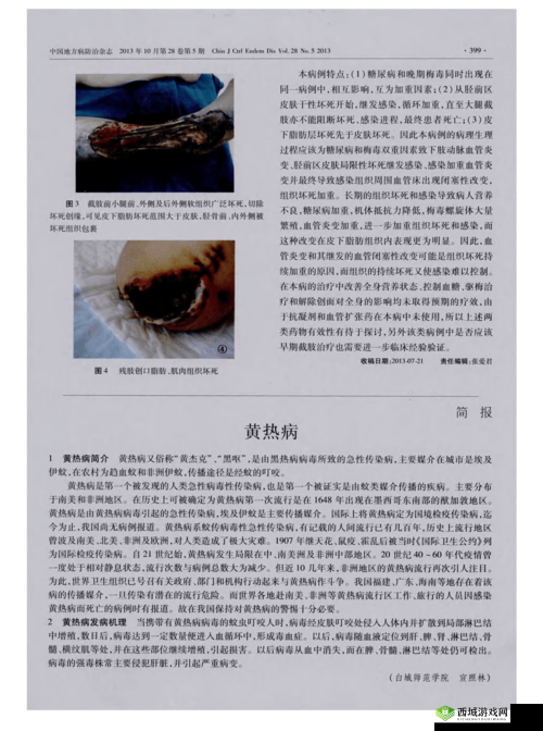 希望之村遭遇黄热病危机，如何治疗？揭秘疗法与未来玩法革新预测